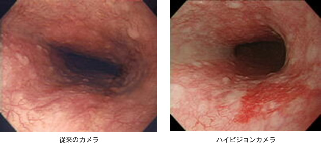 痛くない経鼻内視鏡 鼻からの胃カメラ の特徴 医療法人 佐田厚生会 佐田病院 福岡