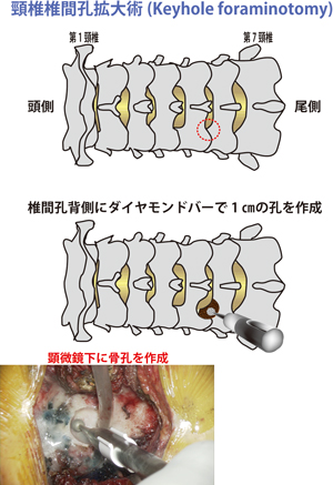 頚椎後面図