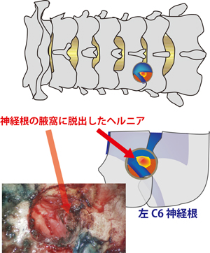 頚椎後面図2