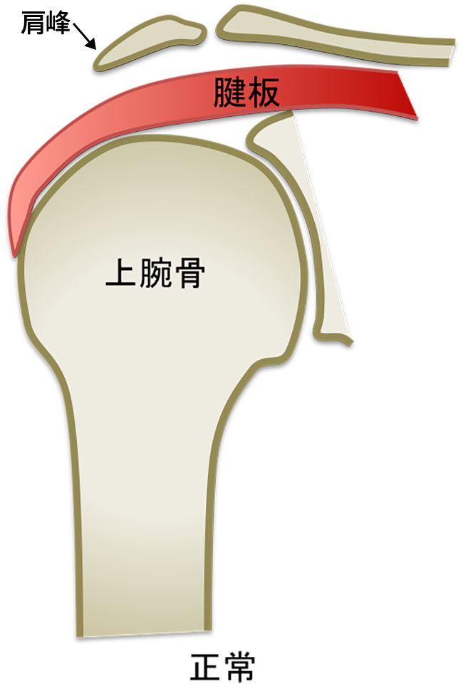 正常
